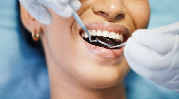 Best Knocked-Out Tooth Emergency  in Sharpes, FL