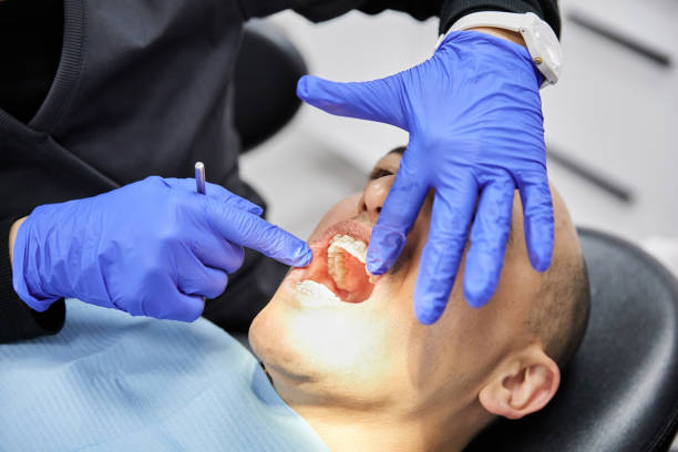 Best Chipped Tooth Repair Near Me  in Sharpes, FL